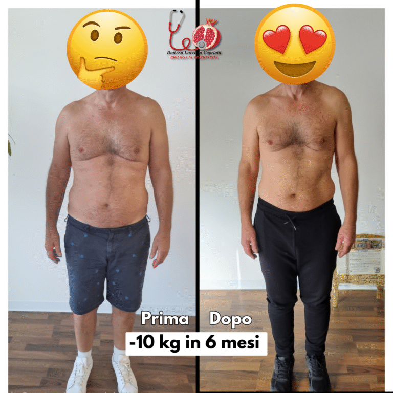 Prima-2